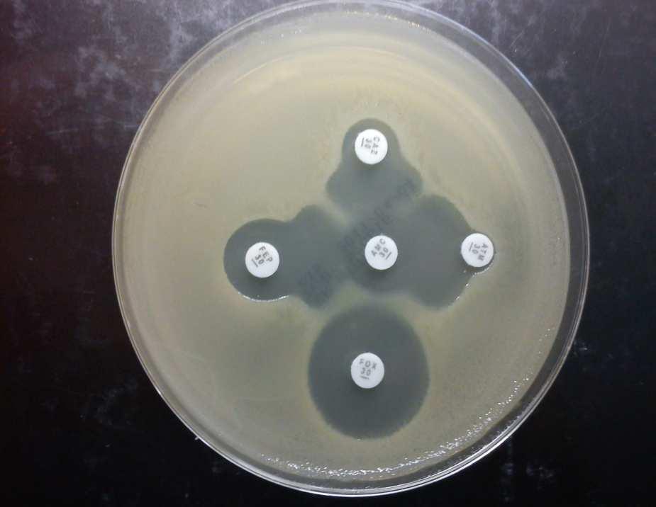 následně na něj byly umístěny antibiotické disky: do centra agaru disk s amoxicilinklavulanátem (20µg/10µg;) a 30 mm (od středu ke středu disku) od něj druhý s oxoiminobeta-laktamem (cefotaxim, 30µg).