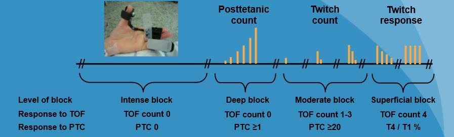 NMBA TOF count TOF ratio PTC Intenzivní 0 n/a 0 Hluboký (DEEP-NMB) 0 n/a 1-2-5 Středně hluboký (moderate) 1-2 n/a (20) Mělký- povrchní