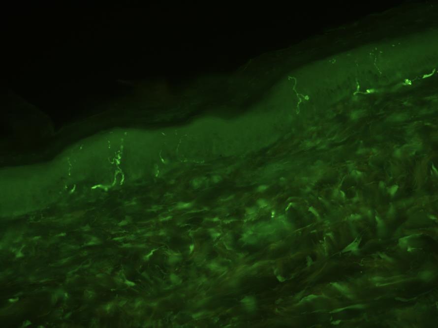 imunohistochemickými metodami a)