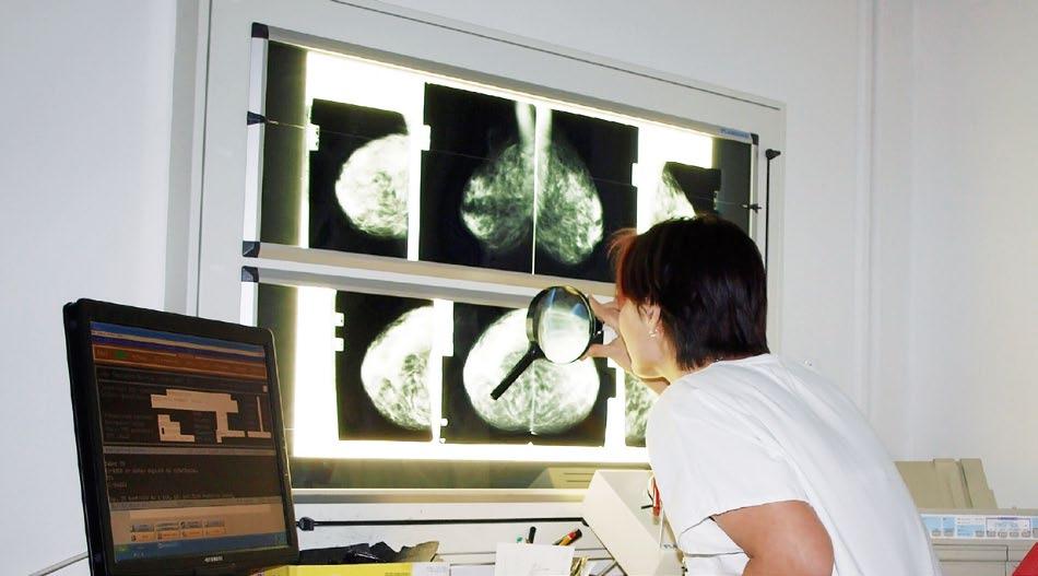 Prezentace jednotlivých oddělení Nemocnice Prostějov 6.1 6.1.22. Radiodiagnostické oddělení Odborný zástupce: prim. MUDr.