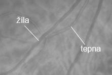 a) b) Obr. 5: a) zobrazení tepen a žil na fundus snímku; b) zobrazení centrálního reflexu opouští zde oko [29].