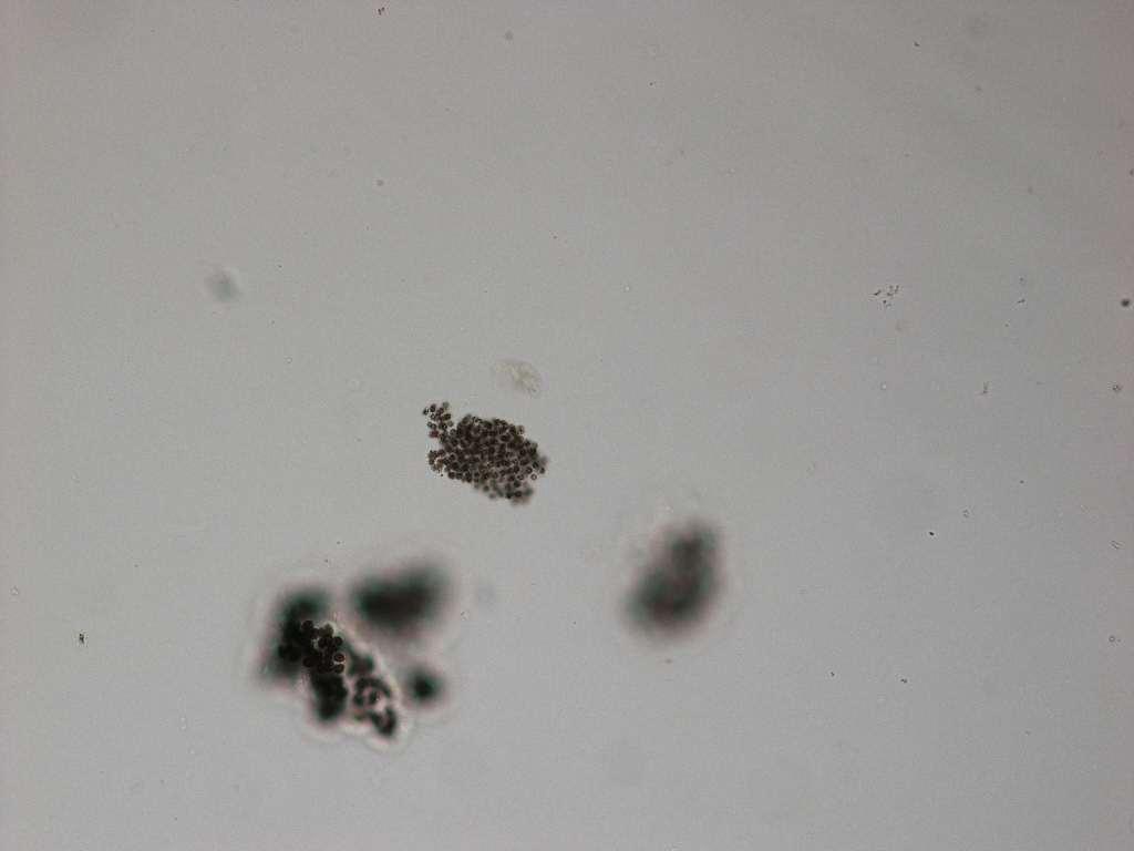 Microcystis flos-aquae?