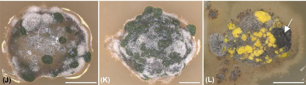 Lichenikolní houby, endolichenické houby interagují s fotobiontem? Muggia et al., 2018: The thallus structure of the lichen symbiosis provides a fungal shelter for the growth of algal partners.