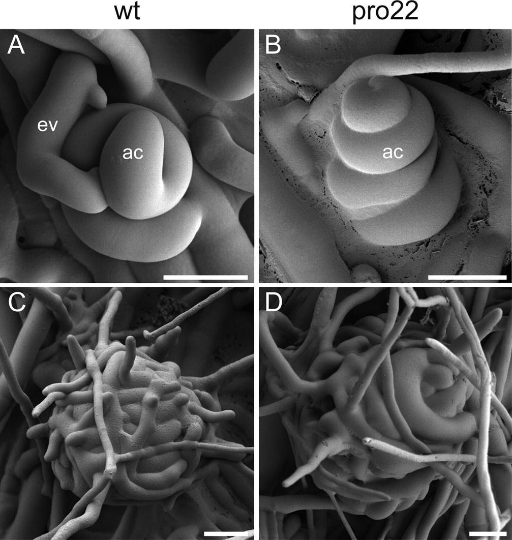(A) Ascogonium (ac) of the Sordaria macrospora, which is just starting to be