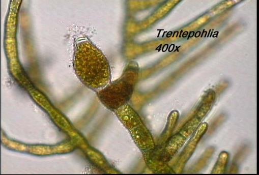 Chlorophyta Trebouxiophyceae Ulvophyceae