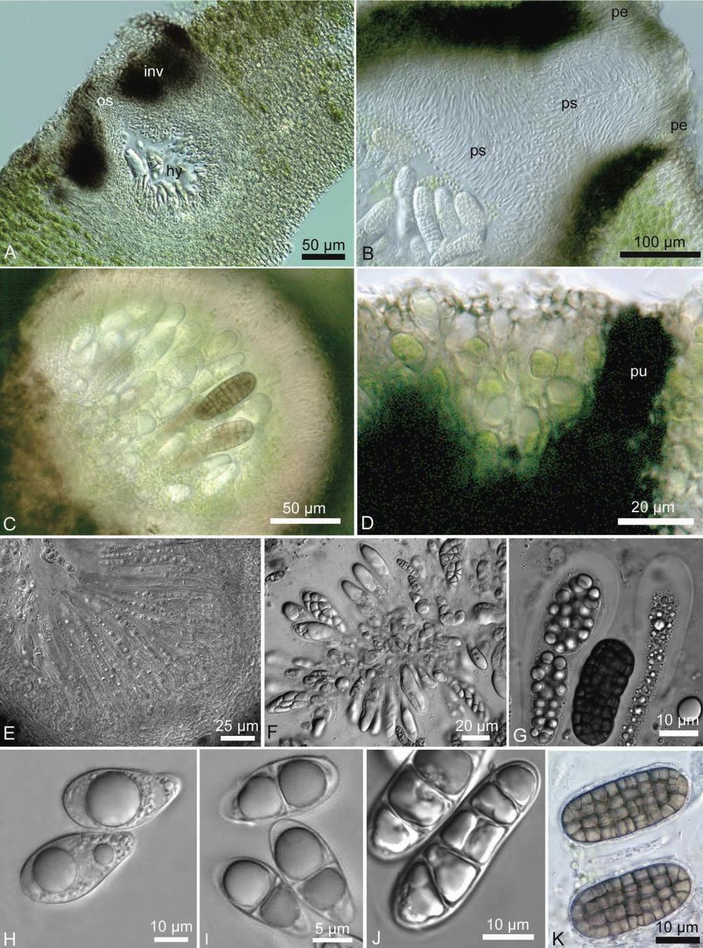 Perithecium, spory Halda J.