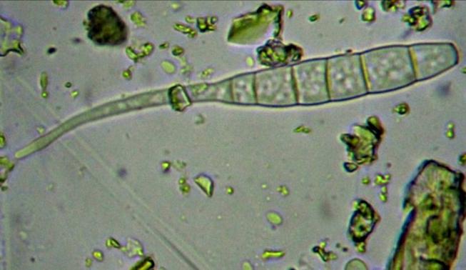 Pythium ultimum Mycocentrospora acerina F.