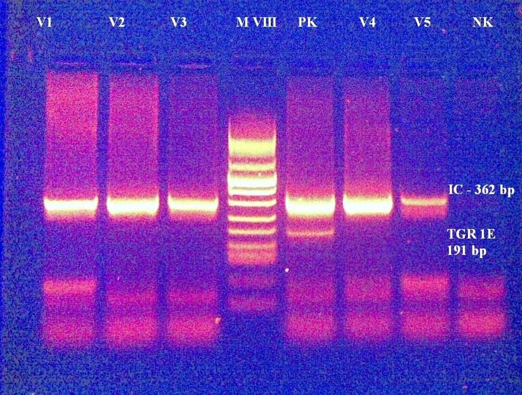 Obr. 5. Elektroforetická detekce PCR produktů na agarózovém gelu 10.2 Metoda 2: Real-time PCR pro 529-bp repetitivní fragment T.