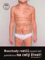 V roce 2011 se konal třetí ročník charitativní kampaně 5 000 000 Kč pro dětský úsměv se společností ROSSMANN, spol. s.r.o. Tento ročník byl naprosto rekordní.