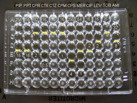Obrázek 15: Diluční test (old.lf3.cuni.cz Diluční metoda) 5.3 E-test Tento test řádíme mezi kvantitativní testy stejně jako diluční test, ale je založen na podobném principu jako diskový difuzní test.
