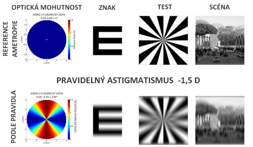 Důsledkem nekorigovaného astigmatismu je neoptimální zraková ostrost do dálky (obrázek 1.2). Při vyšších hodnotách ovlivňuje i vizus do blízka.