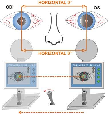 a) b) Obrázek 3.8: Schéma mechanismu kontroly horizontální polohy hlavy pacienta při vyšetření. Obrázek: a) pozitivní kontrola, b) negativní kontrola. Vlastní schéma.