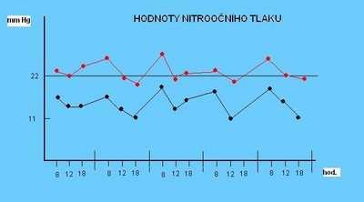 x=15,15 mmhg. Průměrné rozpětí tlaku během dne činilo 2,8 mmhg. Výkyvy NT ale nepřesáhly 5 mmhg viz. tabulka 2. Tab.