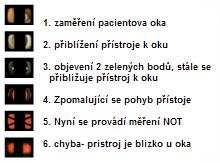 onemocnění glaukomem, ale je vhodné pacienta poslat na vyšetření pachymetrie, kde bude změřena přesná tloušťka pacientovy rohovky a vyšetřující poté usoudí správnou diagnózu.