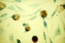 CHLAMYDIOVÉ INFEKCE Přenos choroby: původce Chlamydia