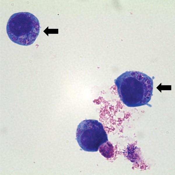 Anaplazmóza Způsobuje bakterie Anaplasma phagocytophylum (dříve Ehrlichia phagocytophila, E.
