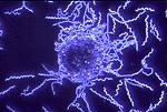 Borrelia