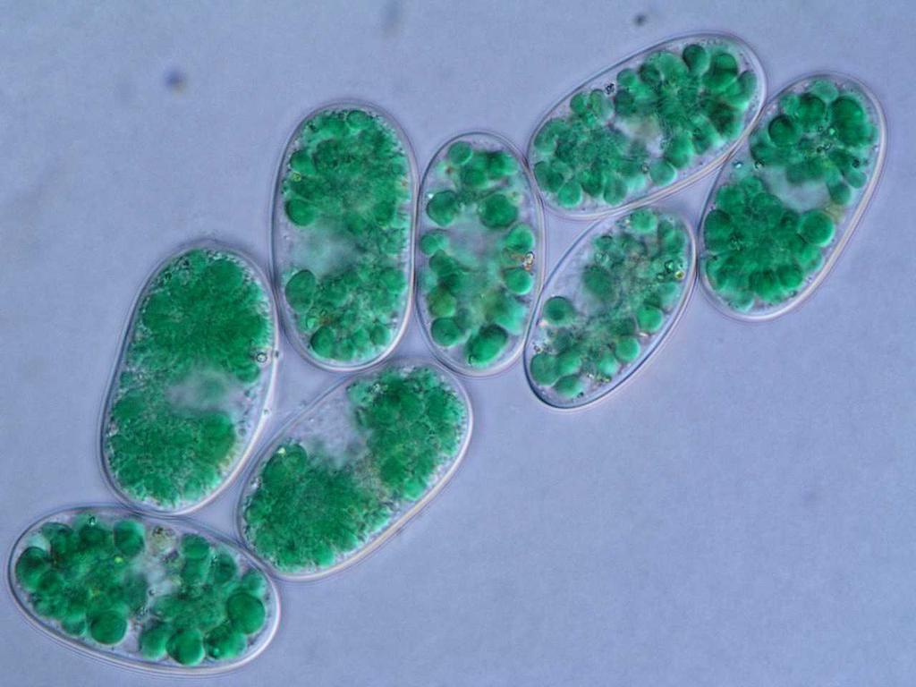 Glaucocystis nostochinearum (příprava preparátu z kultury) Kokální řasa se dvěma cyanelami - symbiotickými sinicemi