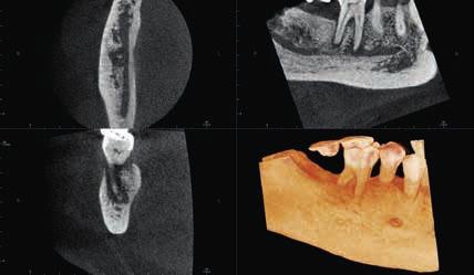 situacích, jako je pořizování pooperačních snímků, plánování implantátů a