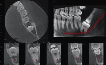 periodontiálních detailů.