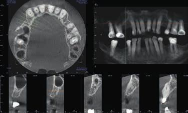 8 cm, horní a spodní čelist s kořenovými