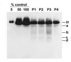 DNA analýzy u 180 dětí s defektem cytochrom c oxidázy (největší světový