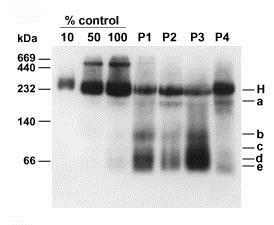 mutace v mtdna 45 dětí 9 dětí 18 dětí Imunoelektroforetické analýzy