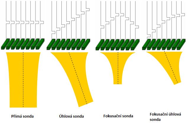 4.2 Základní parametry ultrazvukových sond - jmenovitá frekvence (udává výrobce) - šířka pásma - délka blízkého pole - divergenční úhel - jmenovitý úhel sondy - ohnisko (u fokusačních sond) - úhel