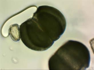 pokožka cibule Příprava vlastních preparátů: chloroplasty v listě