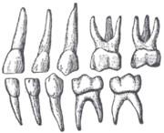 Dentes decidui: velikostí, tvarem i počtem přizpůsobeny dětským čelistem Korunky