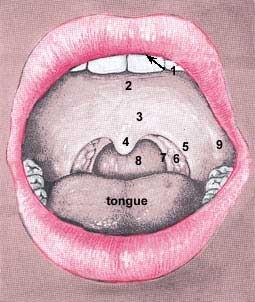 Patrová mandle: (tonsilla palatina) ovoidního tvaru uložený v jamce (sinus