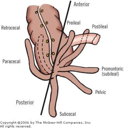 Poloha apendixu je velmi variabilní: do malé pánve (positio pelvina) za slepým střevem (positio retrocaecalis) rovnoběžně s konečnou částí kyčelníku