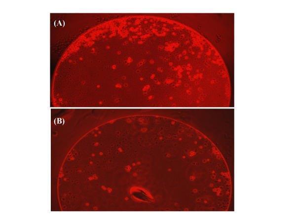 Complement dependent cytotoxicity test (cross-match) Since 1970s prospective