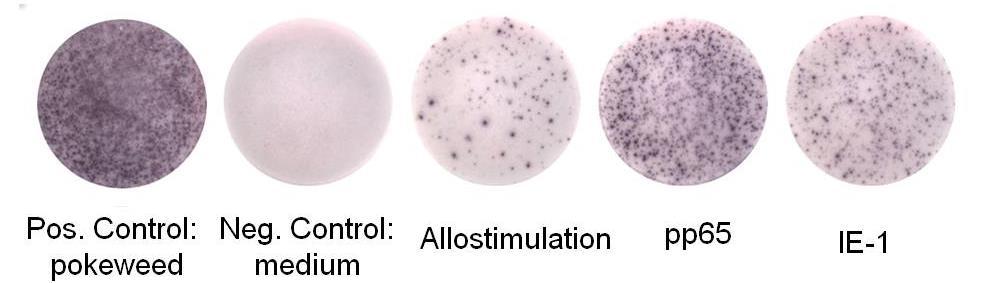 ELISPOT Recipient PBMC + Donor PBMC (depleted) YYYYYYYYYY 24h incubation Biotinylated secondary Ab Y Y Y