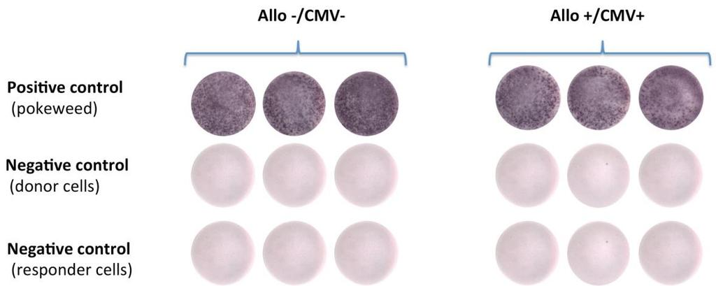 Cellimin study: ELISPOT based trial Low risk patient High risk patient < 25 spots
