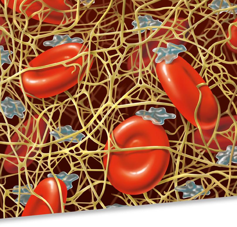 Reference: 1. Rossaint et al., The European guideline on management of major bleeding and coagulopathy following trauma: fourth edition, Critical Care (2016) 20:100. 2. Kozek-Langenecker SA et al.