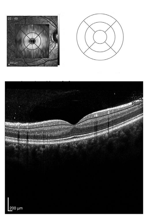 Neurologická zobrazovací vyšetření u očních onemocnění Chwalisz a spol.