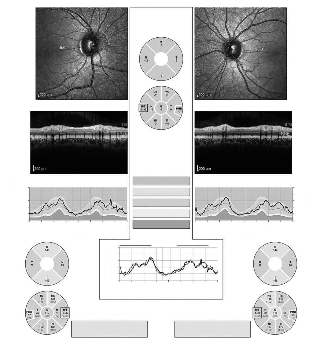 Neurologická zobrazovací vyšetření u očních onemocnění Chwalisz a spol.