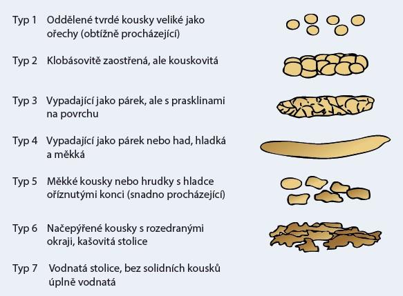 Fyziologické funkce dle monitorace: TK 90/55 mmhg TF 90/min sat. O2 94 % U večerní vizity jsem upozornila lékaře na pozitivní bilanci tekutin (+4040 ml/12 hod), a aplikovala jsem Furon 20 mg i.v. bolus.