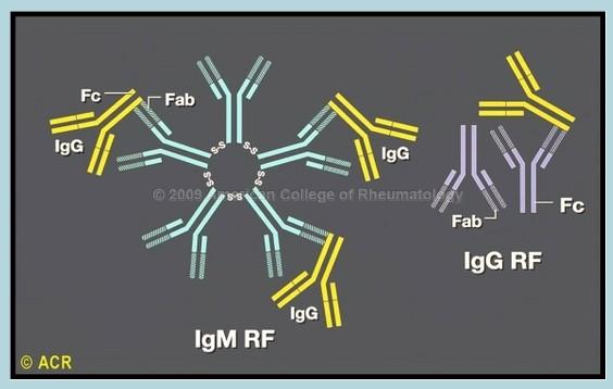 Revmatoidní faktor (RF) je protilátka proti Fc fragmentu molekuly IgG běžně se vyskytuje v