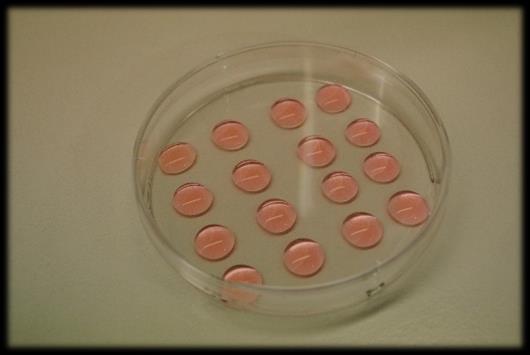 Chronologický postup činnosti: - Připravit aspirační, wash a maturační médium. - Finální příprava aspiračního média (Dulbecco s PBS) pro OPU.