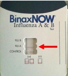 1c/ Komunitní pneumonie s atypickým patogenem virovým Influenzavirus typ A, B, C subtyp HxNx (H1N1, H3N2)