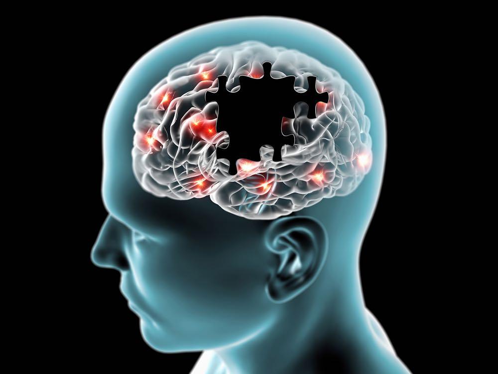 AI diagnostikuje Alzheimeru chorobu Strojové zpracování přirozené řeči 80%