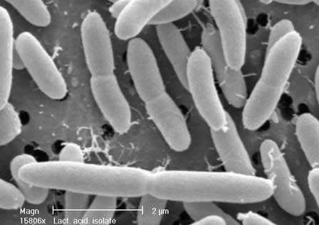 UTB ve Zlíně, Fakulta technologická 15 Lactobacillus acidophilus Kmeny Lactobacillus acidophilus mají pro své vhodné vlastnosti rozsáhlé použití v mlékárenské výrobě, zdravotnictví i veterinární