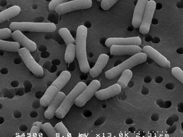 UTB ve Zlíně, Fakulta technologická 16 Lactobacillus casei V přírodě velmi rozšířený. Je součástí sýrařských kultur, zakysaných mlék, nachází se v silážích a zažívacím ústrojí.