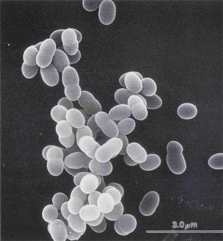UTB ve Zlíně, Fakulta technologická 18 1.4.3 Rod Lactococcus Jedná se o grampozitivní fakultativně anaerobní homofermentativní koky tvořící diplokoky a řetízky, rostou při 10 C, nerostou při 45 C.