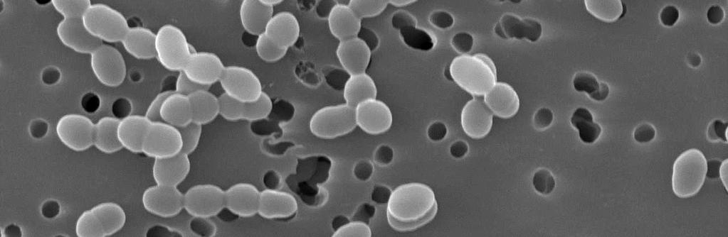 lactis je podporován růst základní kultury. Tvoří organické kyseliny, oxid uhličitý a ethanol. Leuconostoc mesenteroides subsp.