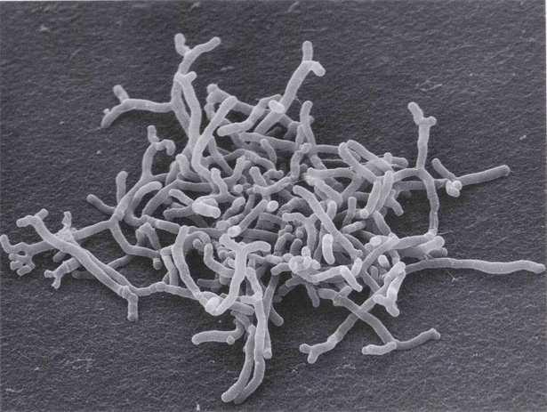 5 Rod Bifidobacterium Tyčinky různého tvaru, který je často ovlivněn kultivačními podmínkami.