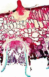 Spermogonium