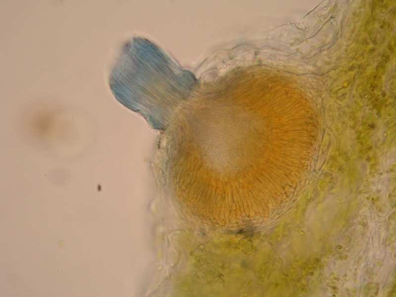 Receptivní hyfy spermacie Spermogonium rzi